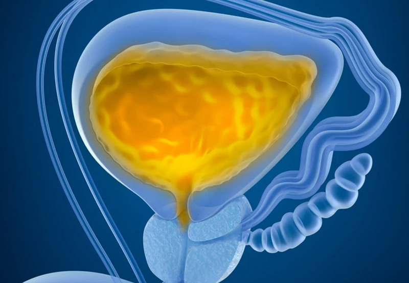 medical-concept-of-neurogenic-bladder-Dr.-Kai-Wen-Chuang medical-concept-of-neurogenic-bladder-Dr.-Kai-Wen-Chuang